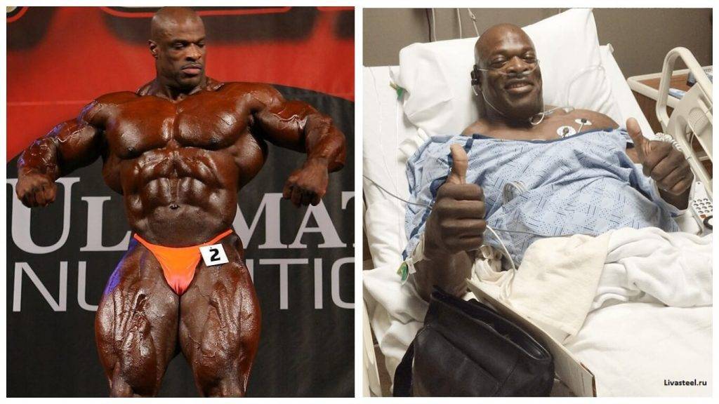 Рацион победителей Мистер Олимпия — как питаются чемпионы?