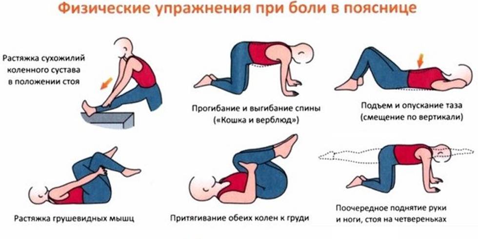 Что делать если болит поясница: причины, способы лечения и упражнения при болях в пояснице