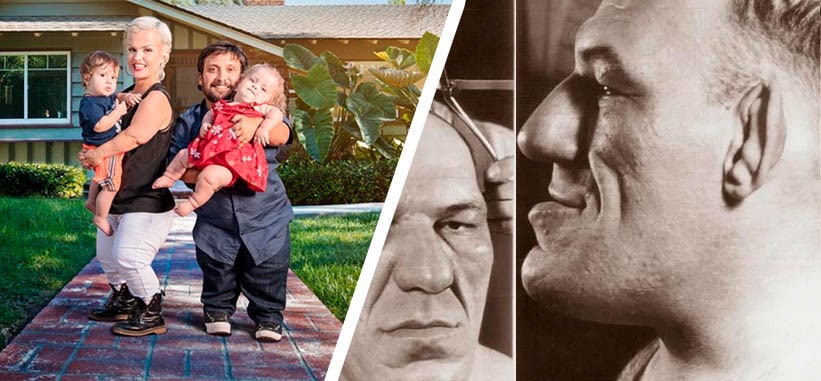 Последствия влияния гормона роста на организм человека: побочки и вред