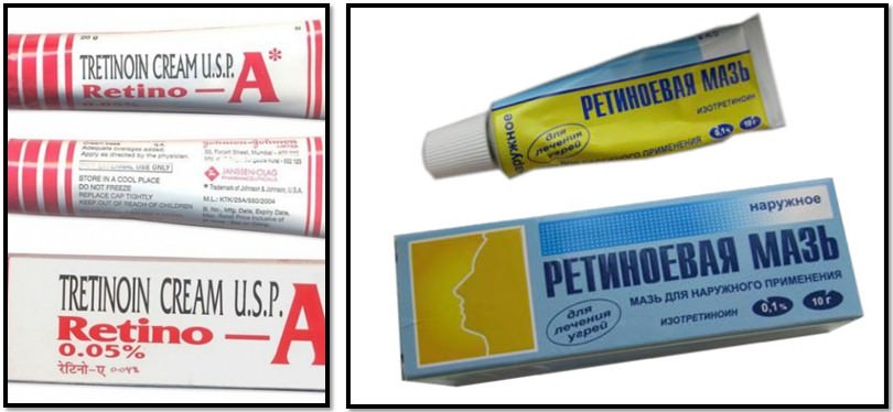 Почему у одних нет растяжек, но это не их заслуга, а вы не виноваты в своих?