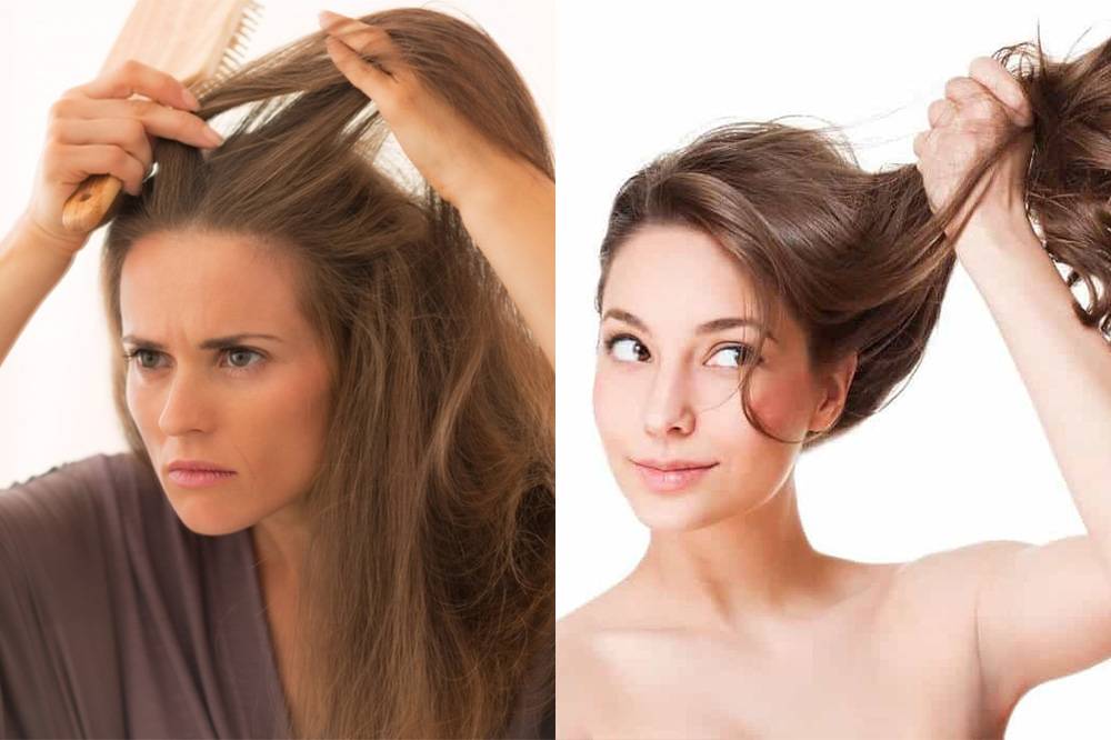 Самые эффективные народные средства от выпадения волос