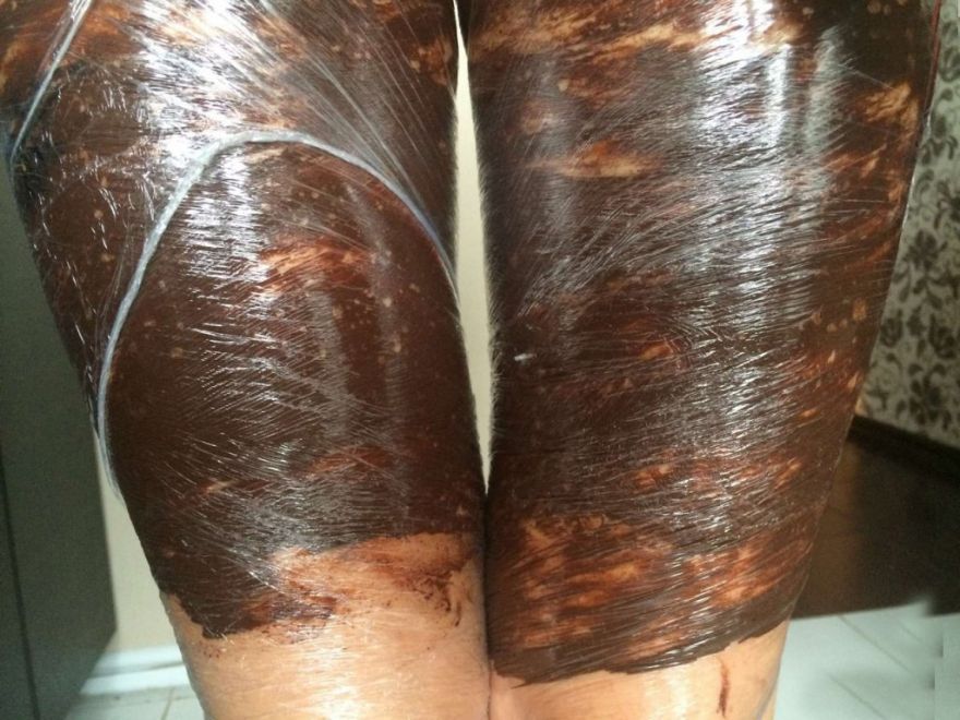 Обертывание для похудения в домашних условиях: 5 лучших рецептов средств для обертывания тела