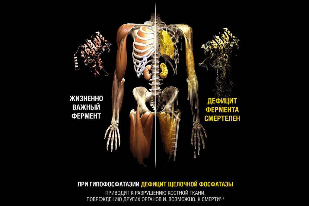 Почему болят суставы: 5 наиболее вероятных причин болей