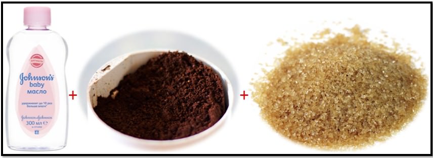 Почему у одних нет растяжек, но это не их заслуга, а вы не виноваты в своих?