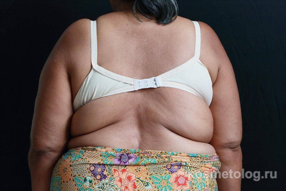 Процент жира в организме: как узнать, фото примеры