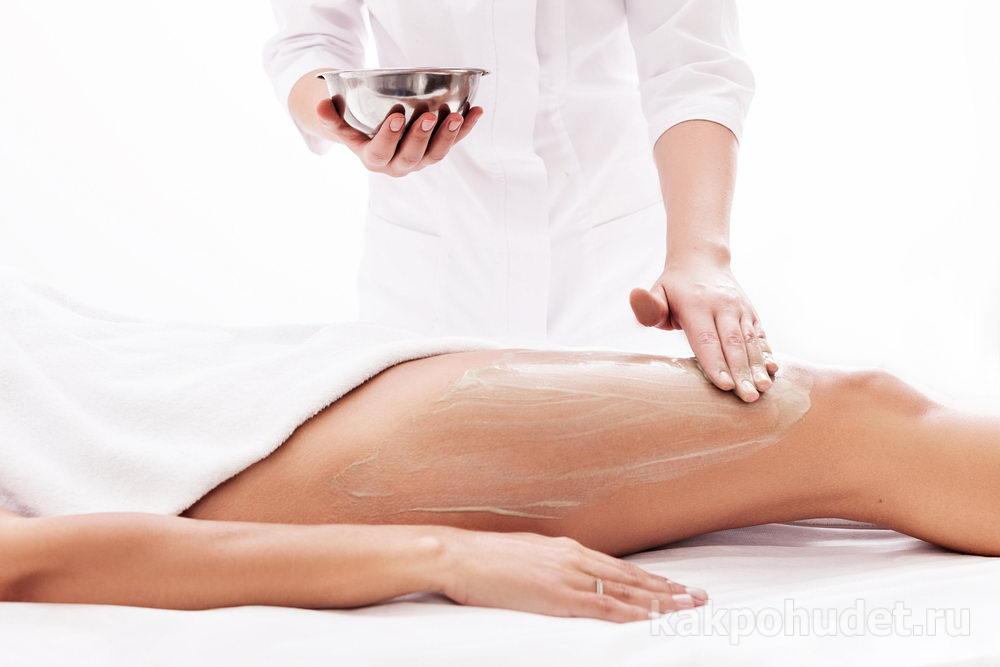 Что такое целлюлит