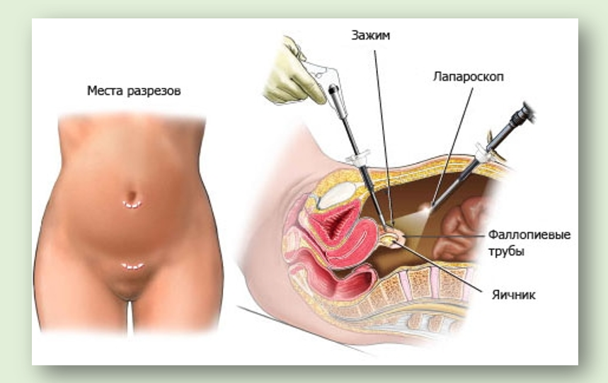 Как женщины кастрируют мужчин