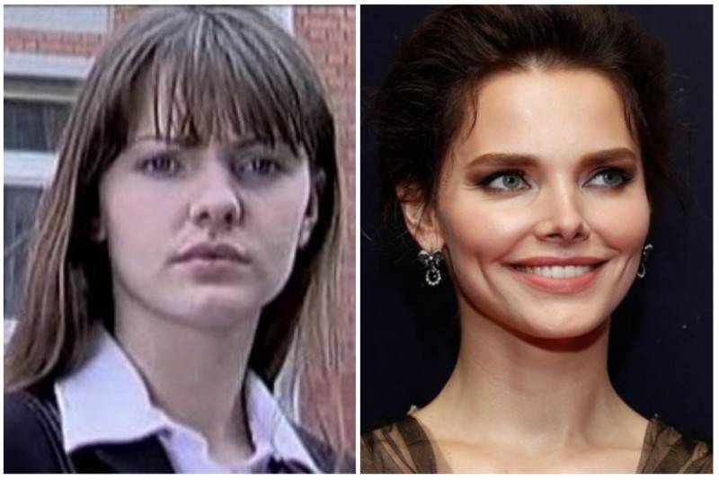 5 российских звезд, который делали липоскульптурирование: фото до и после