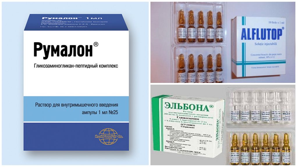 Хондропротекторы: рейтинг по эффективности 7 препаратов из топ списка лучших